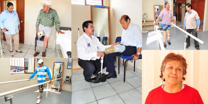 Ofrece el DIF Estatal Guanajuato servicios del taller de Órtesis y Prótesis