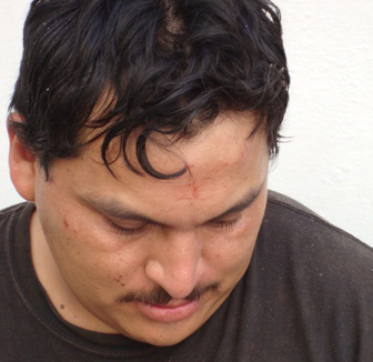 Herido en riña en el Centro