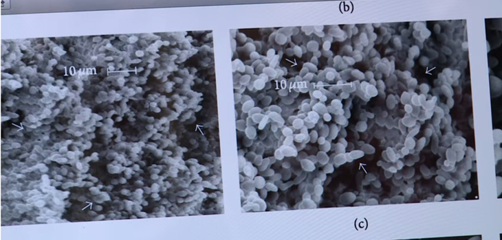 Desarrollan en la UG base de vacuna contra candidiasis