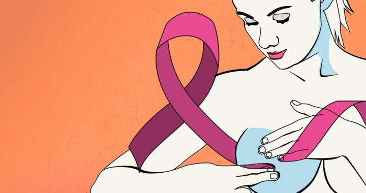 Van 131 mujeres identificadas con cáncer de mama en Guanajuato 