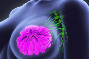 Piden autoridades capitalinas a las mujeres, acudir a la revisión para prevenir cáncer de mama