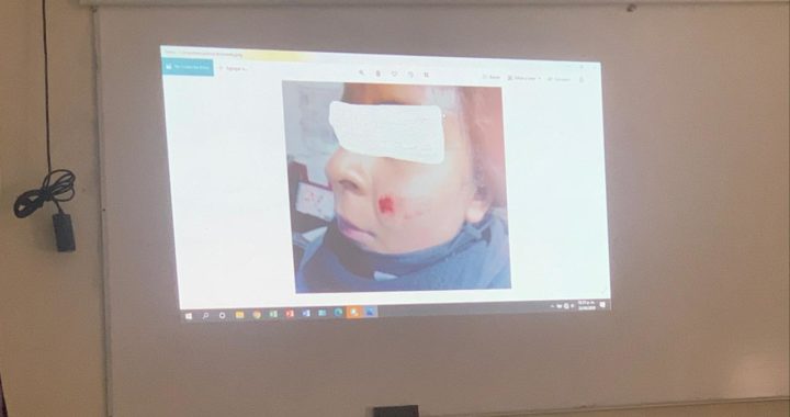 Interpone secretaría demanda por agresión a policías; niegan que hubo disparos