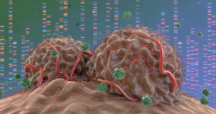 Analizar el cáncer desde las causas y no desde los tejidos*