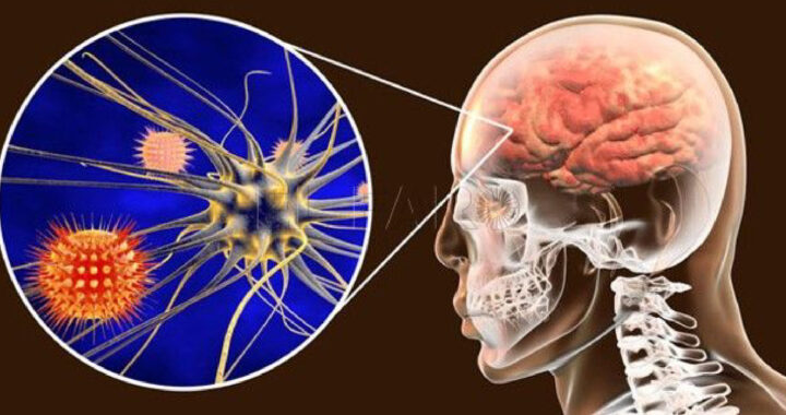 No hay brotes de meningitis en Guanajuato