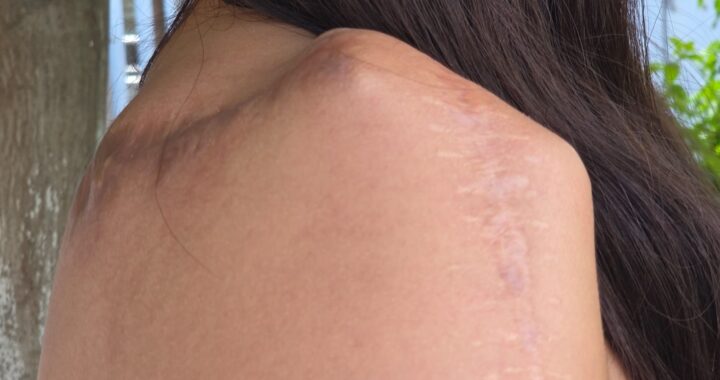 Edith Alejandra, compañera de Yael, busca superarse y pasar el trauma de hace 4 años
